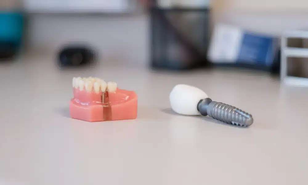 tooth extraction