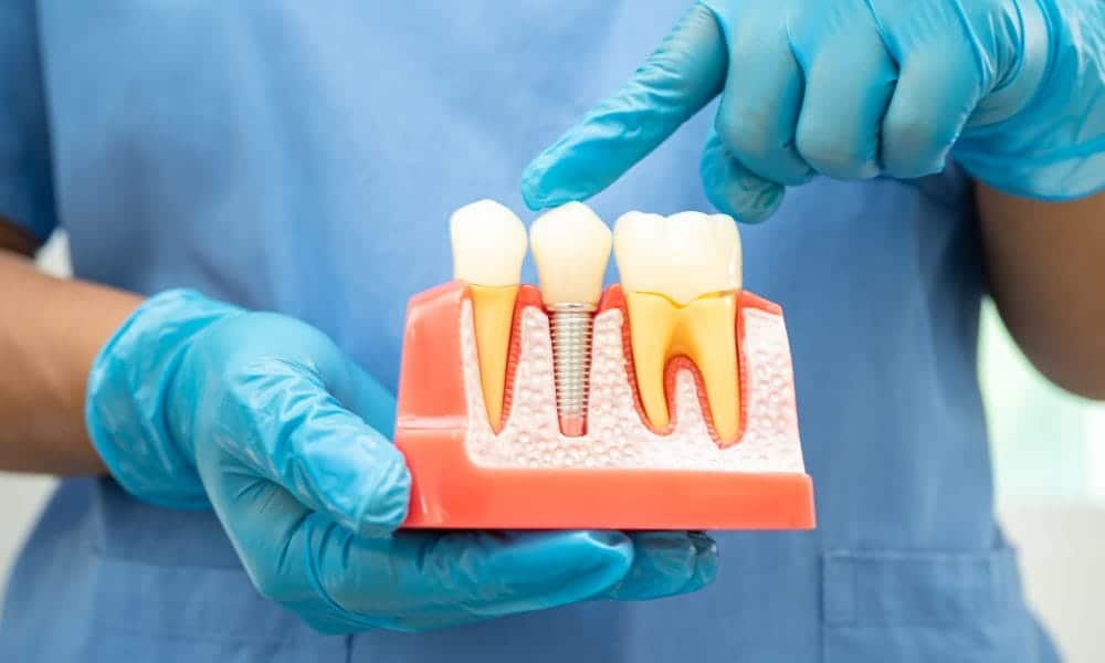 Thinking About Dental Implants? Why an Oral Surgery Consultation Comes First