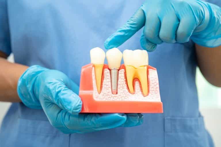 Thinking About Dental Implants? Why an Oral Surgery Consultation Comes First